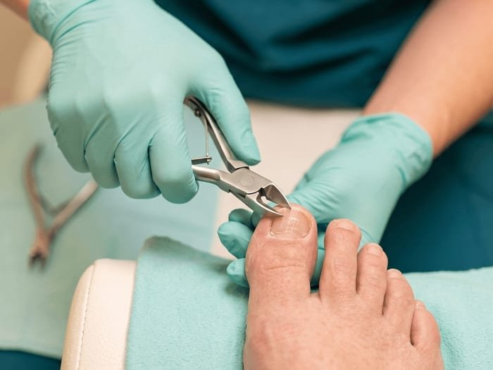 Pés bem cuidados sobre toalha, com unhas cortadas de forma reta e instrumental estéril embalado ao lado